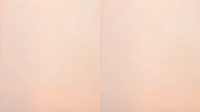 图片[4] - [Korean BJ] yomimi1 2026-03-01 - KBJFan