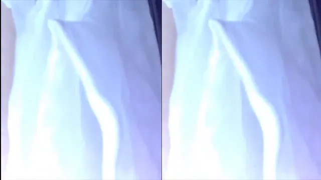 图片[11] - [Korean BJ] hehe0000 2024-12-27 - KBJFan