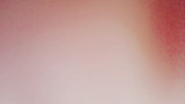 图片[2] - [Korean BJ] dlsrl990 2025-03-05 - KBJFan