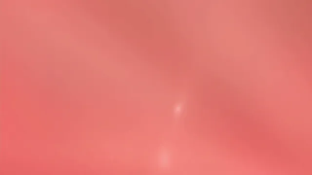 图片[6] - [Korean BJ] yomimi1 2026-03-10 - KBJFan