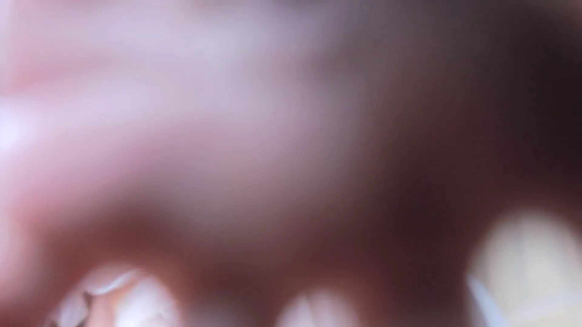 图片[9] - [Korean BJ] moem9e9 2024-06-22 - KBJFan