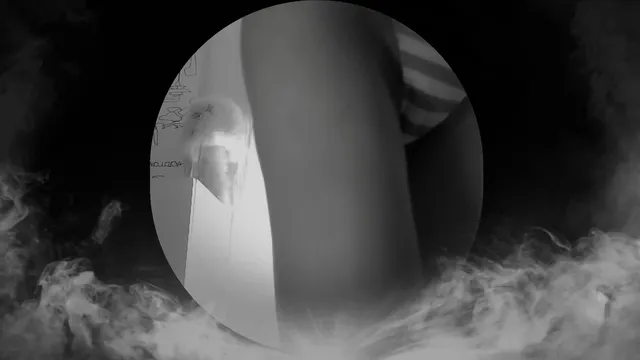 图片[2] - [Korean BJ] rlaekwnd111 2025-08-16 - KBJFan